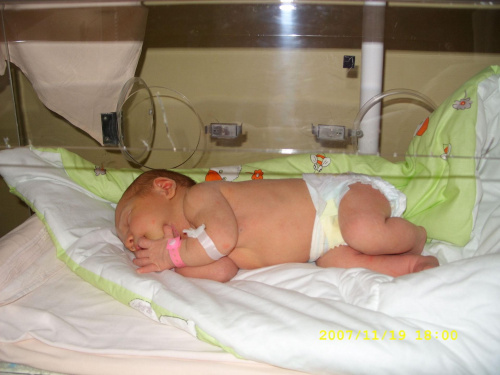 Magdalenka w inkubatorze - fototerapia